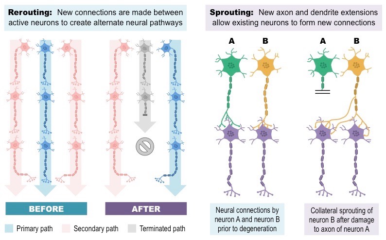 Diagram depicting neuroplasticity in the human brain