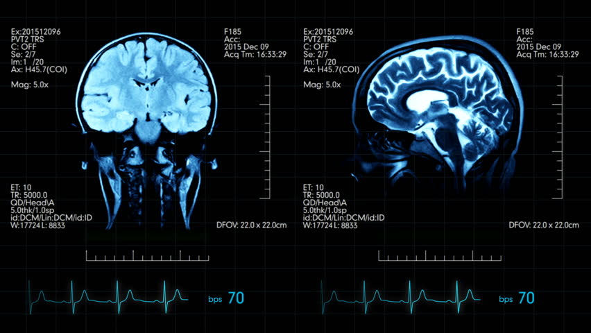 Image depicts data retrieved from an MRI brain scan.